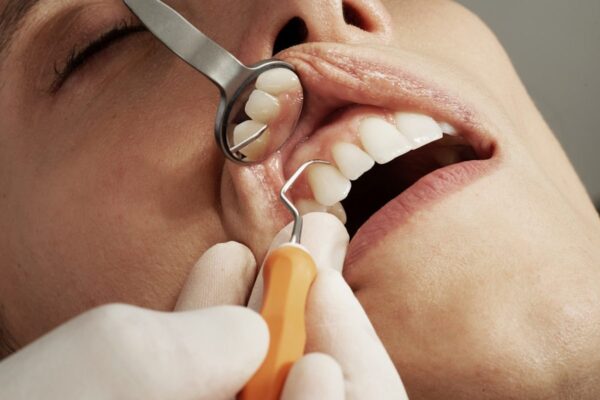 Dental Work in Barranquilla: Costs, Clinics, and What to Expect (2026)